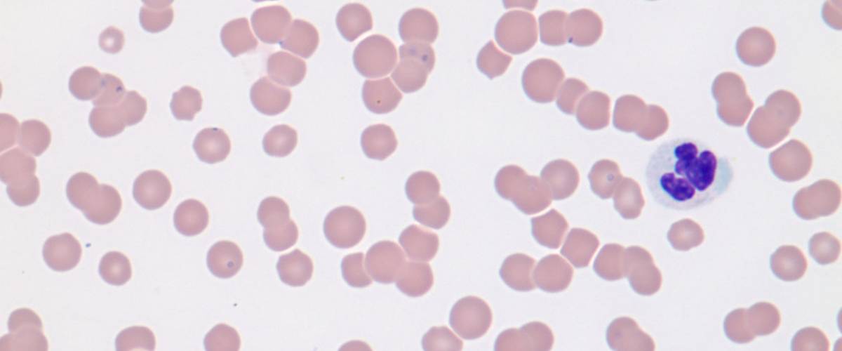 Blood Parasites in Cats and Dogs