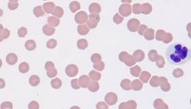 Blood Parasites in Cats and Dogs