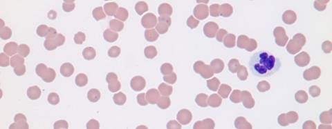 Blood Parasites in Cats and Dogs